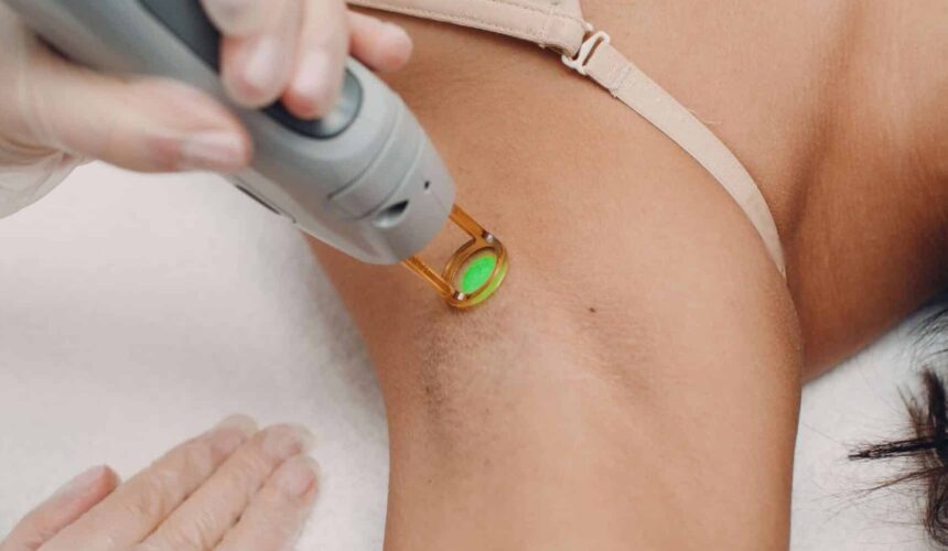 Epilation Laser
