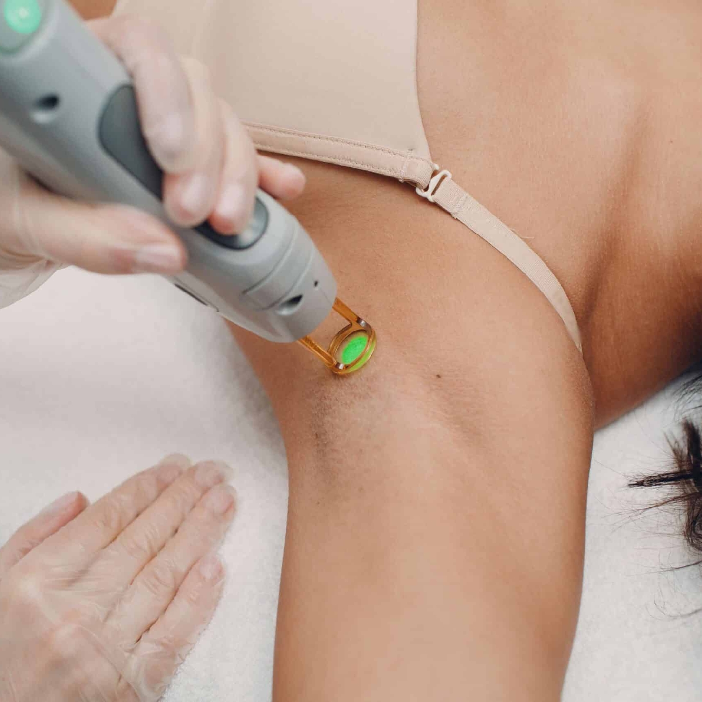 Epilation Laser